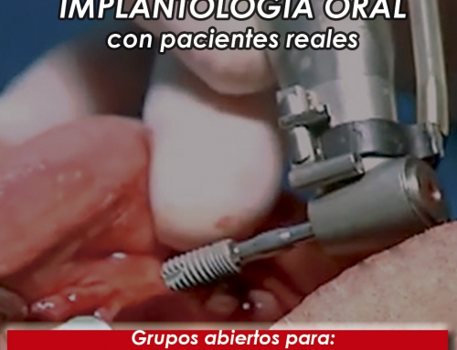 Curso intensivo de Implantología Oral – Grupos Abiertos Segundo Semestre